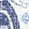 Gray/Blue Medallion Disc